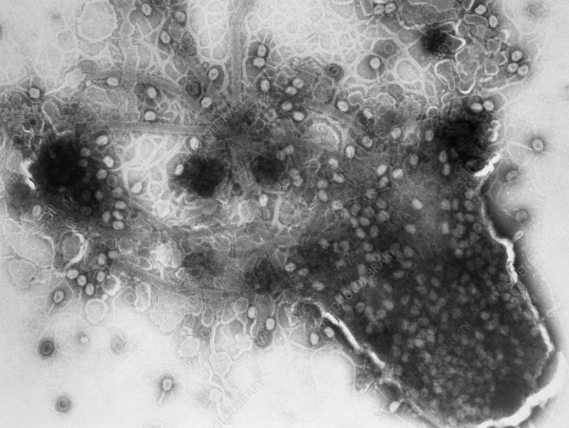 Transmission Electron Microscopy (TEM) showing the lysis of a bacterium.