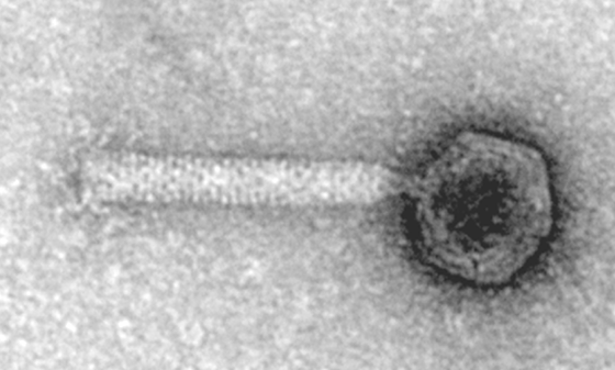 Foto TEM del batteriofago phiCDHM1